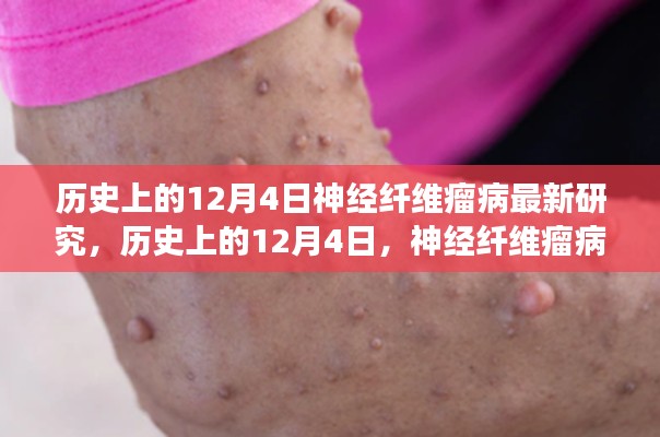 歷史上的神經(jīng)纖維瘤病研究之旅，與自然美景共舞，探尋內(nèi)心寧靜港灣的新突破