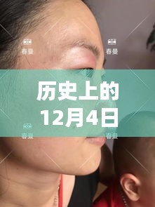 革命性雀斑最新技術(shù)誕生，重塑美顏新紀(jì)元，歷史上的十二月四日里程碑式突破