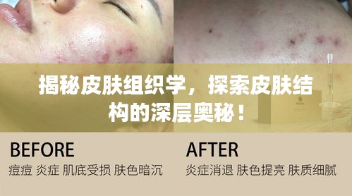 揭秘皮膚組織學(xué)，探索皮膚結(jié)構(gòu)的深層奧秘！