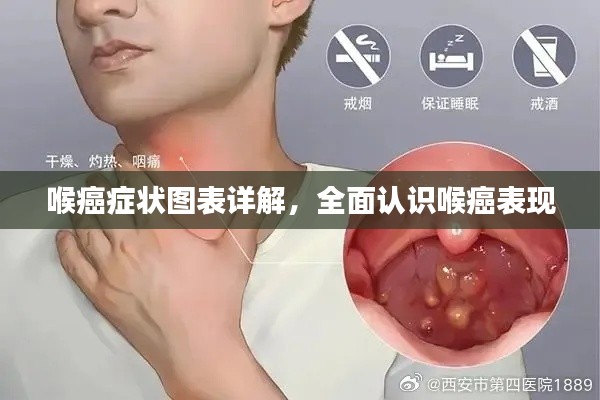 喉癌癥狀圖表詳解，全面認(rèn)識(shí)喉癌表現(xiàn)