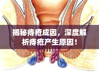 揭秘痔瘡成因，深度解析痔瘡產(chǎn)生原因！