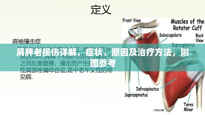 肩胛老損傷詳解，癥狀、原因及治療方法，附圖參考