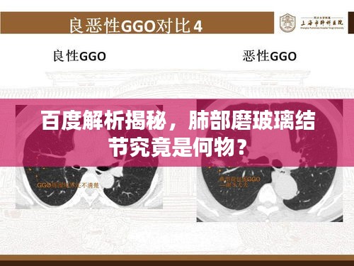 百度解析揭秘，肺部磨玻璃結(jié)節(jié)究竟是何物？