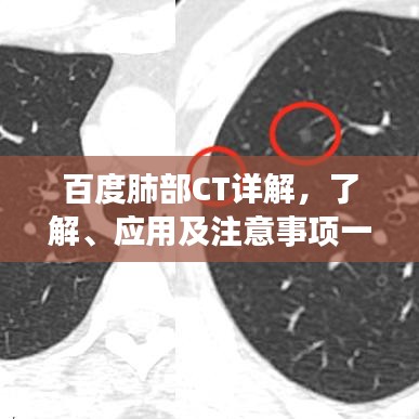 百度肺部CT詳解，了解、應用及注意事項一網打盡