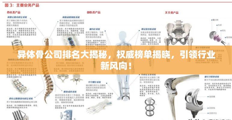 異體骨公司排名大揭秘，權(quán)威榜單揭曉，引領(lǐng)行業(yè)新風(fēng)向！
